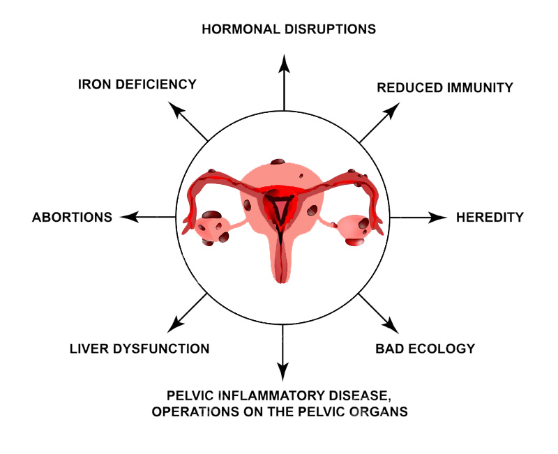 Эндомитоз у женщины. Патогенез эндометриоза. Эндометриоз патогенез. Классификация эндометриоза.