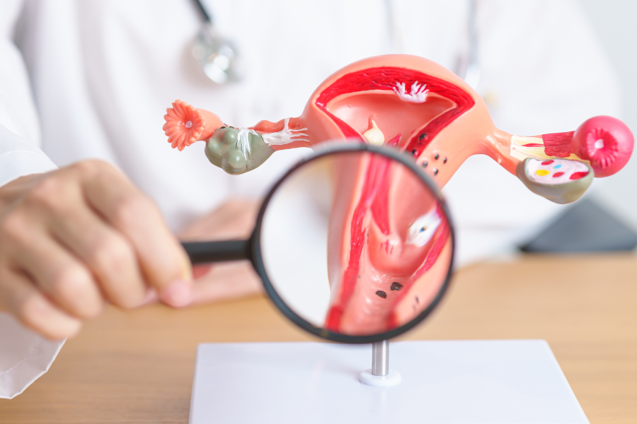 Overcoming Infertility: A Successful Pregnancy with Homeopathy