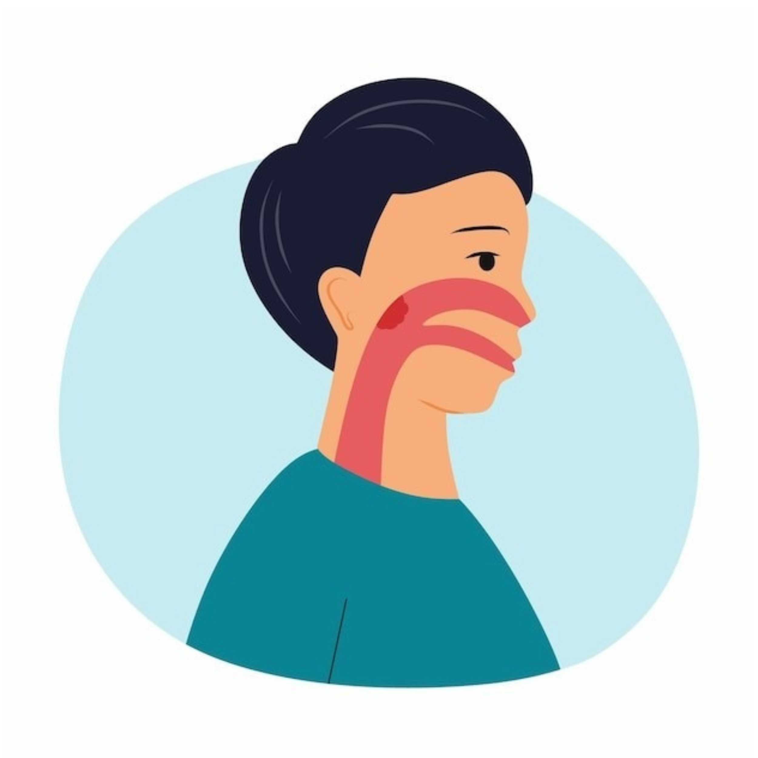Acid Peptic Disease 