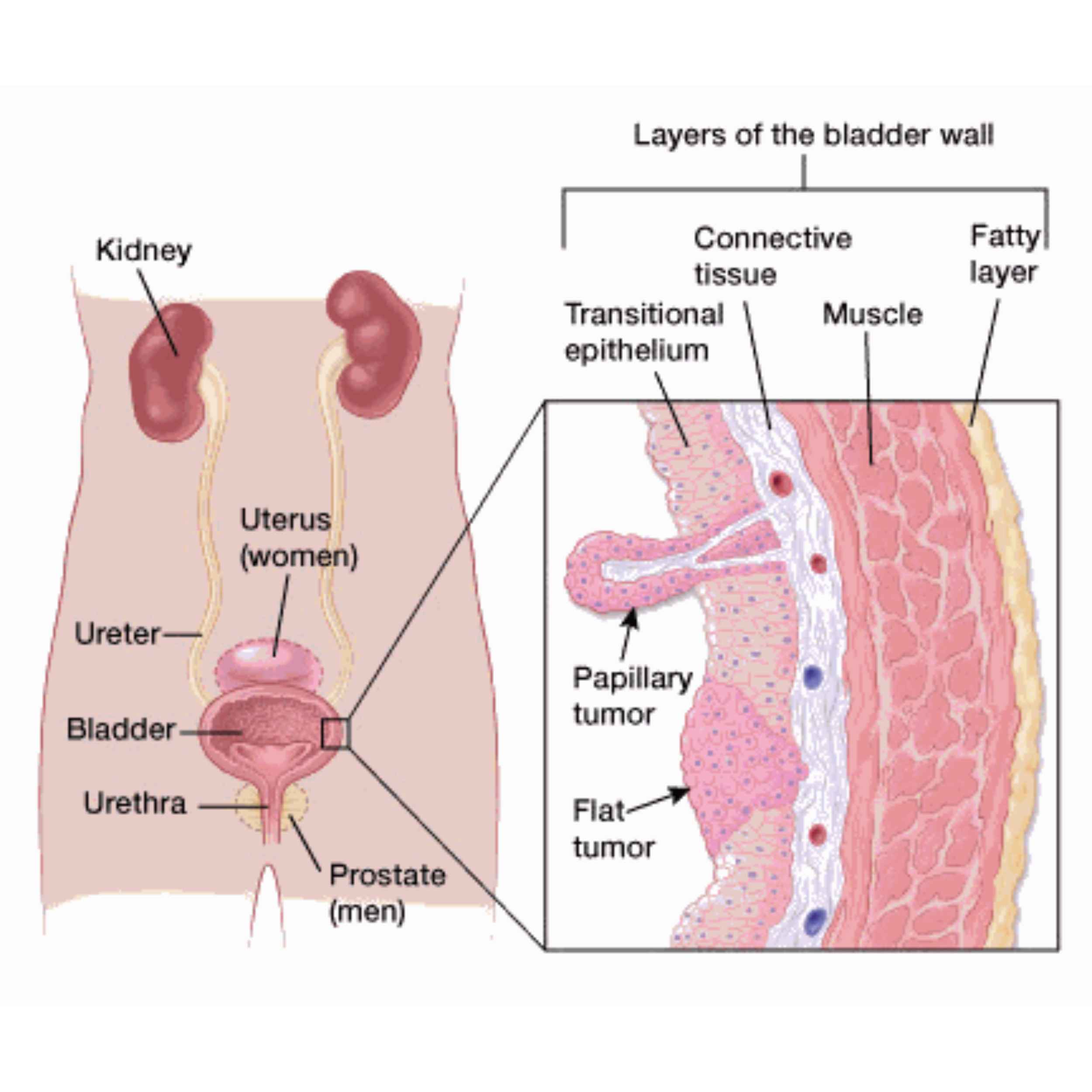 Acid Peptic Disease 