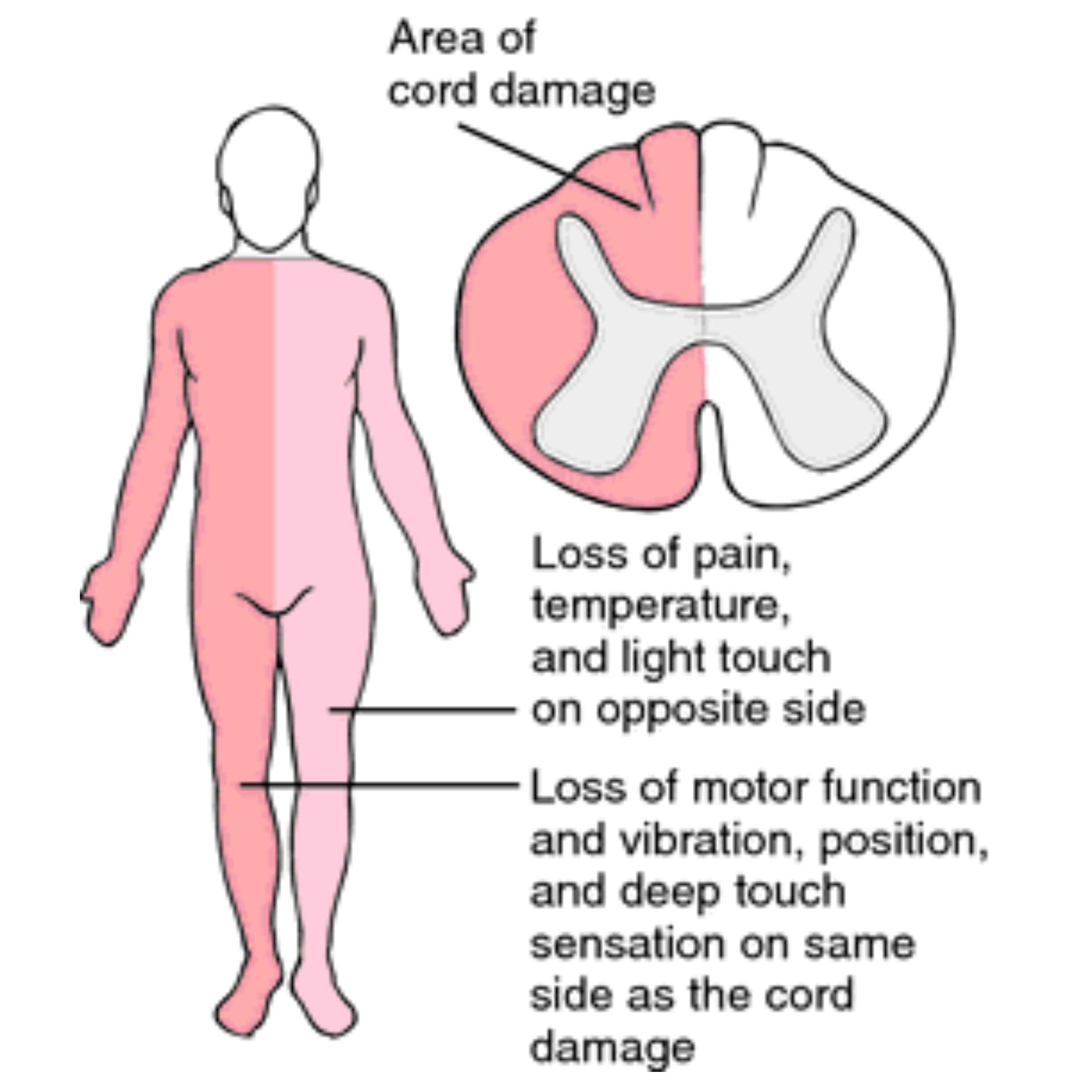 Acid Peptic Disease 