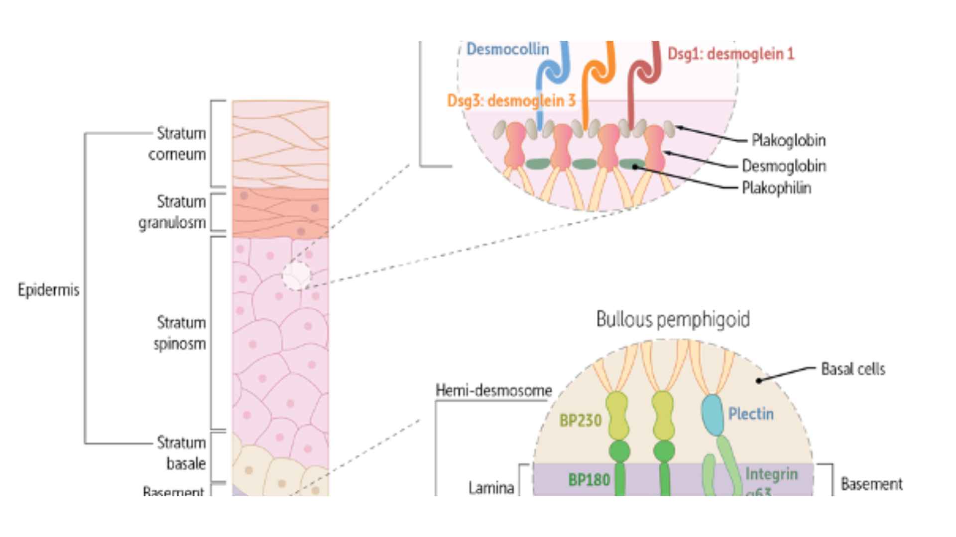 Acid Peptic Disease 