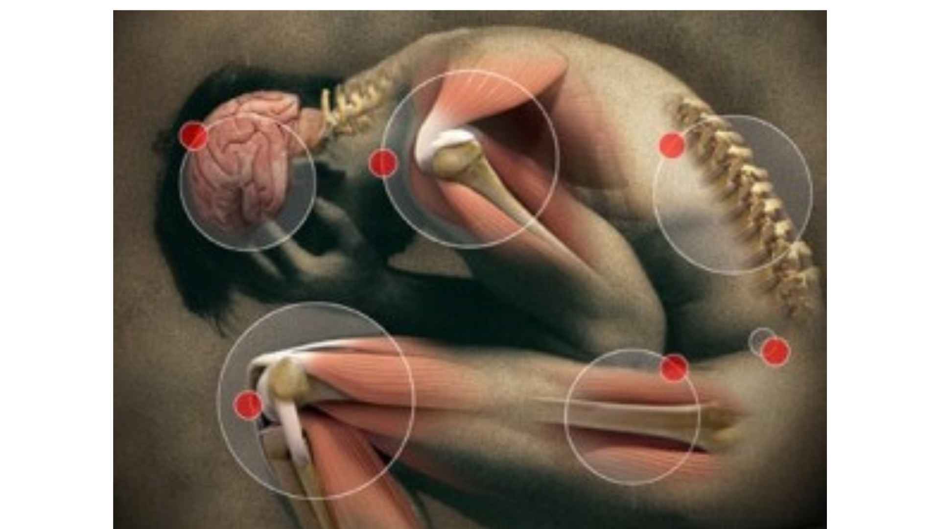 Acid Peptic Disease 