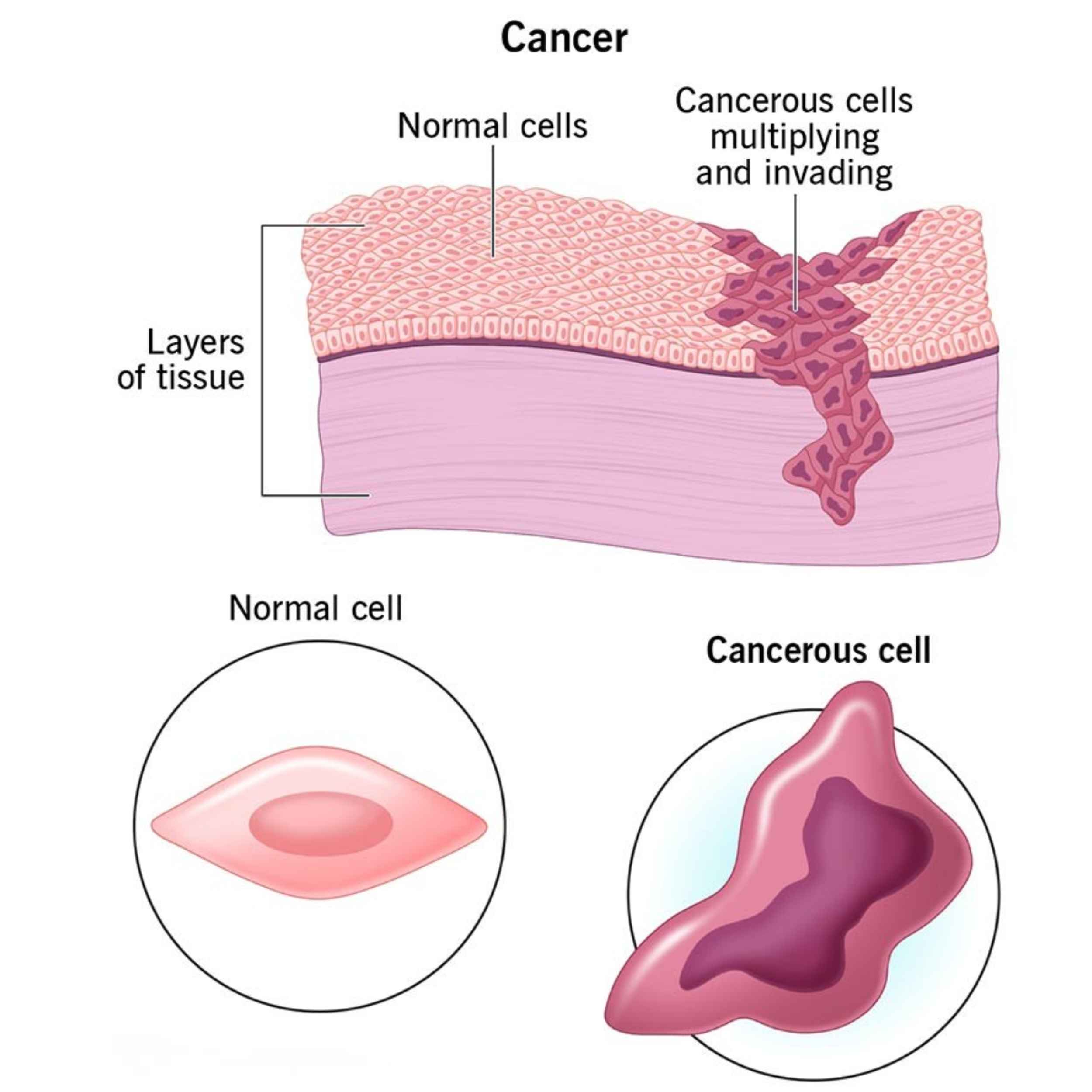 Acid Peptic Disease