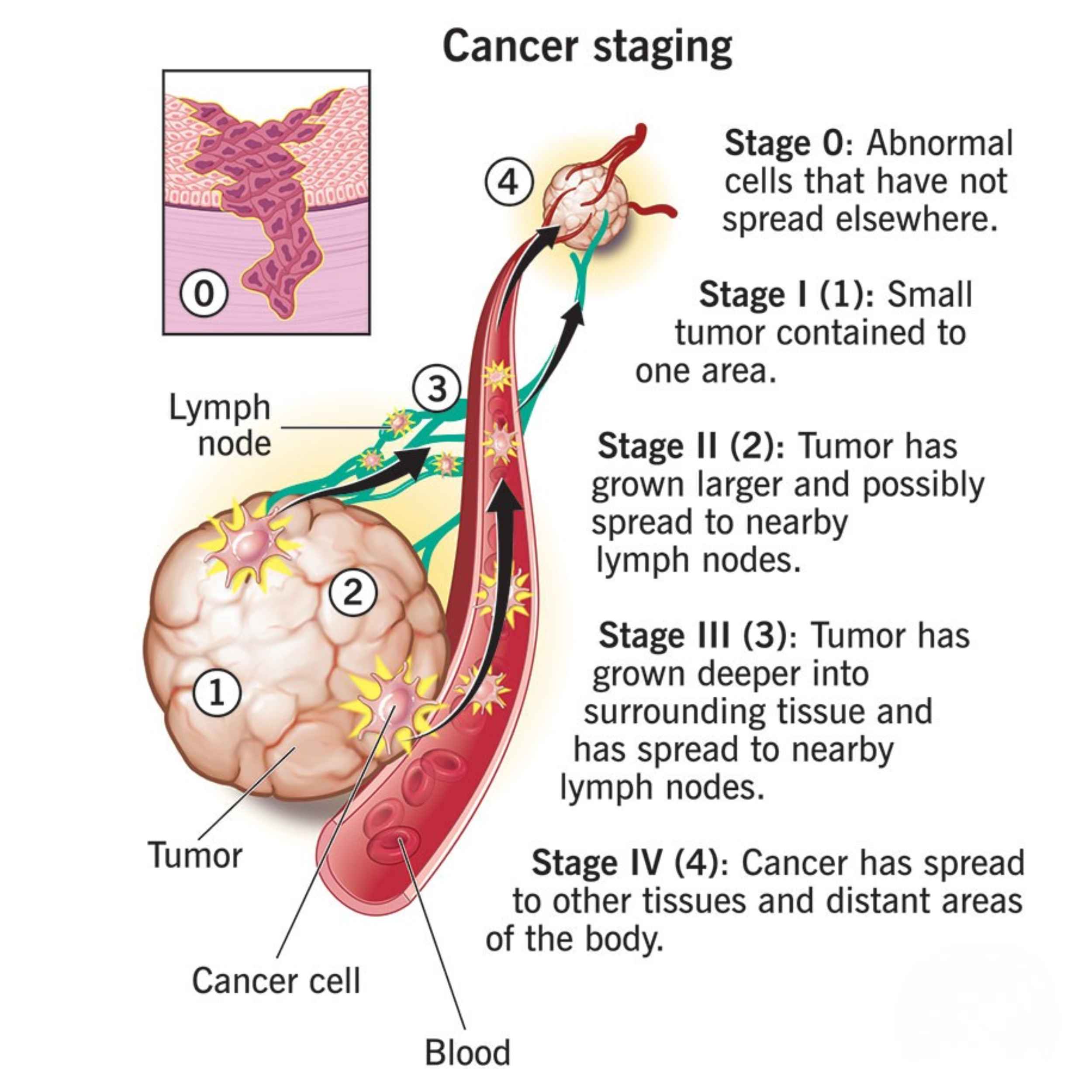 Acid Peptic Disease