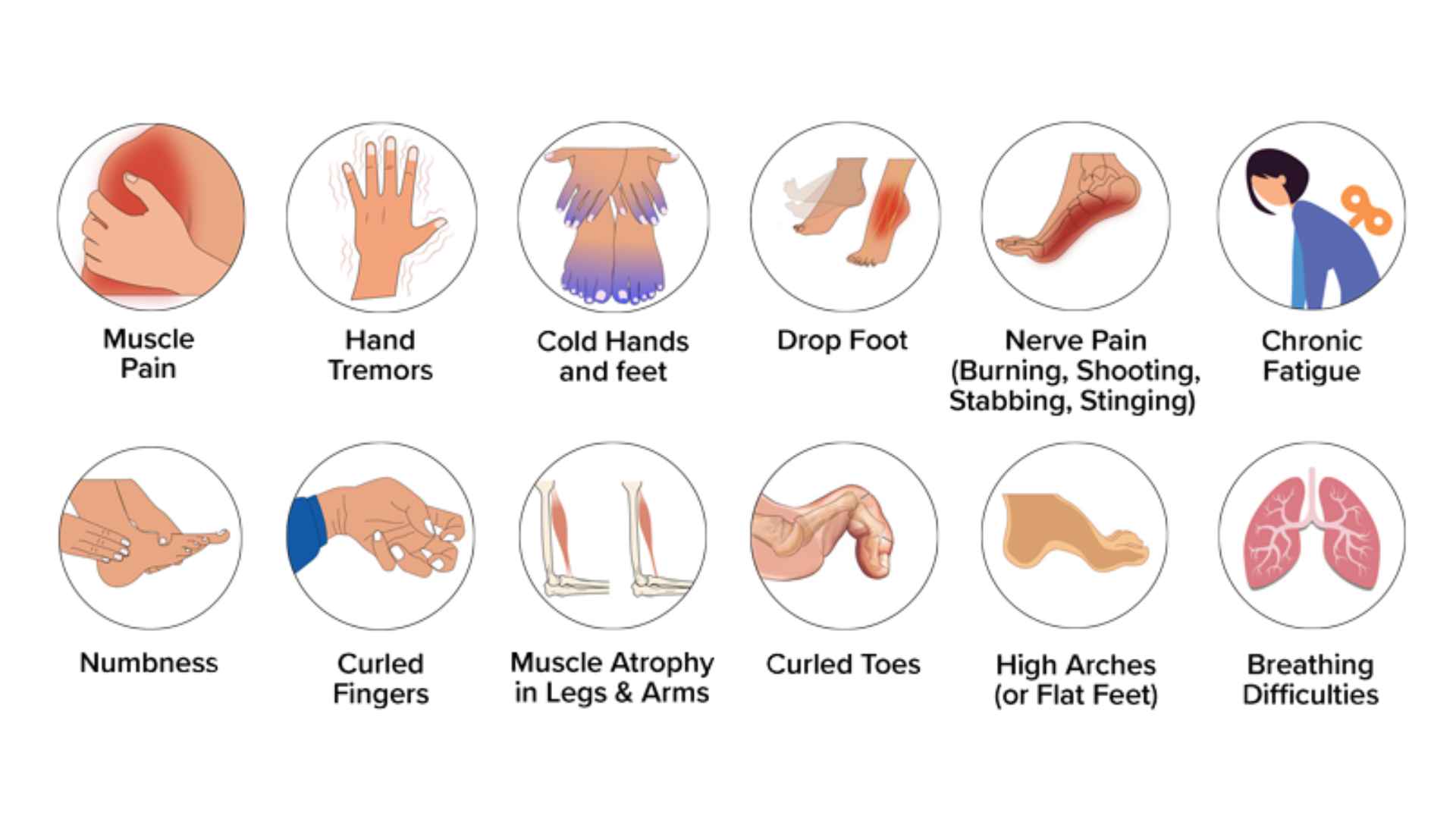Acid Peptic Disease 