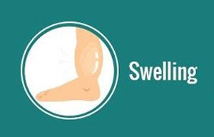 Symptoms of Cellulitis