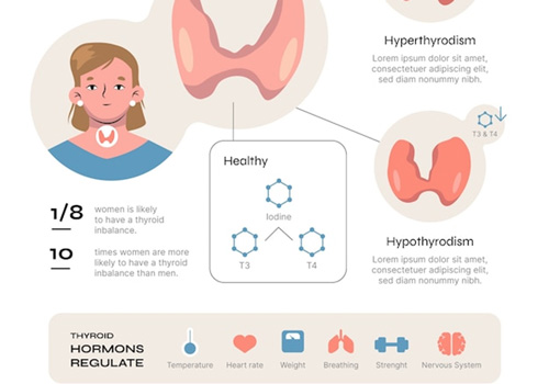 Hashimoto's Thyroiditis