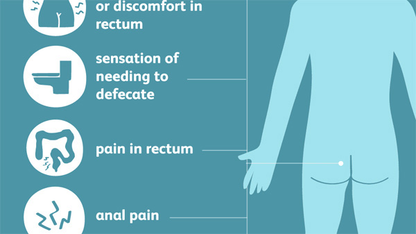 Hemorrhoid Symptoms