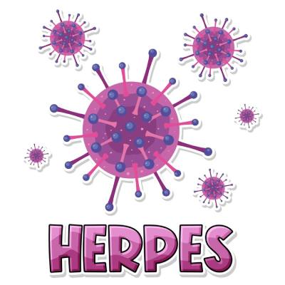 herpes zoster