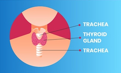 hypo thyroidism