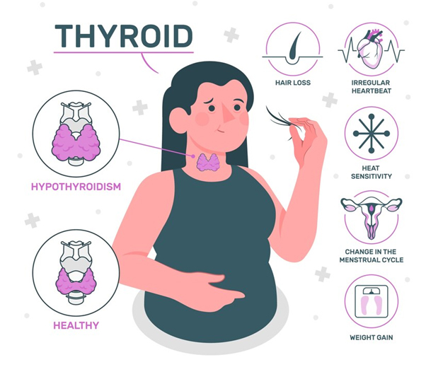 Hypothyroidism