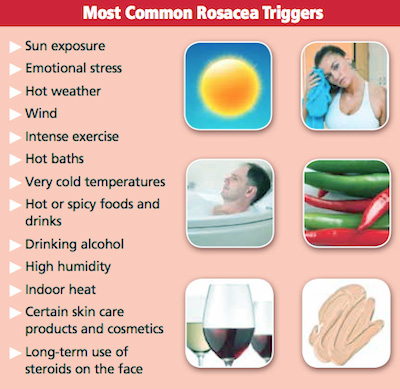 Rosacea