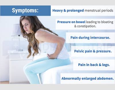 uterine fibroids types