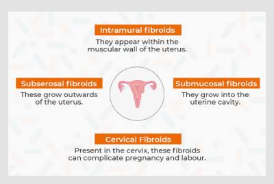 uterine fibroids types