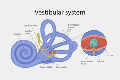 Vestibular Neuritis